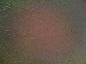 Picture of rosebud drywall texture